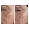 Glycolic Acid 7% Exfoliating Toner