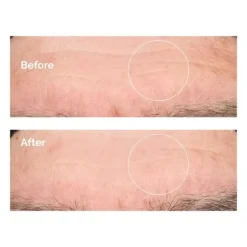 Hyaluronic Acid 2% + B5