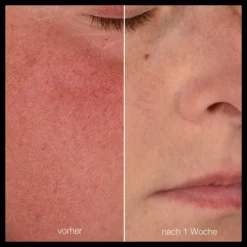 Stabilizing Repair Cream