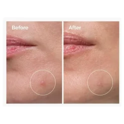 Sulfur 10% Powder-to-Cream Concentrate